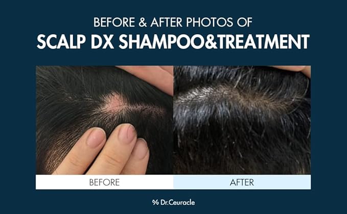Dr. Ceuracle Scalp DX Scaling Shampoo 500ml