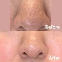 Medicube Zero Pore Pad 155g