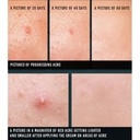 Pyunkang Yul Acne Spot Cream 15ml