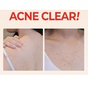 Some By MI Aha Bha Pha 30 Days Miracle Acne Clear Body Cleanser 400g