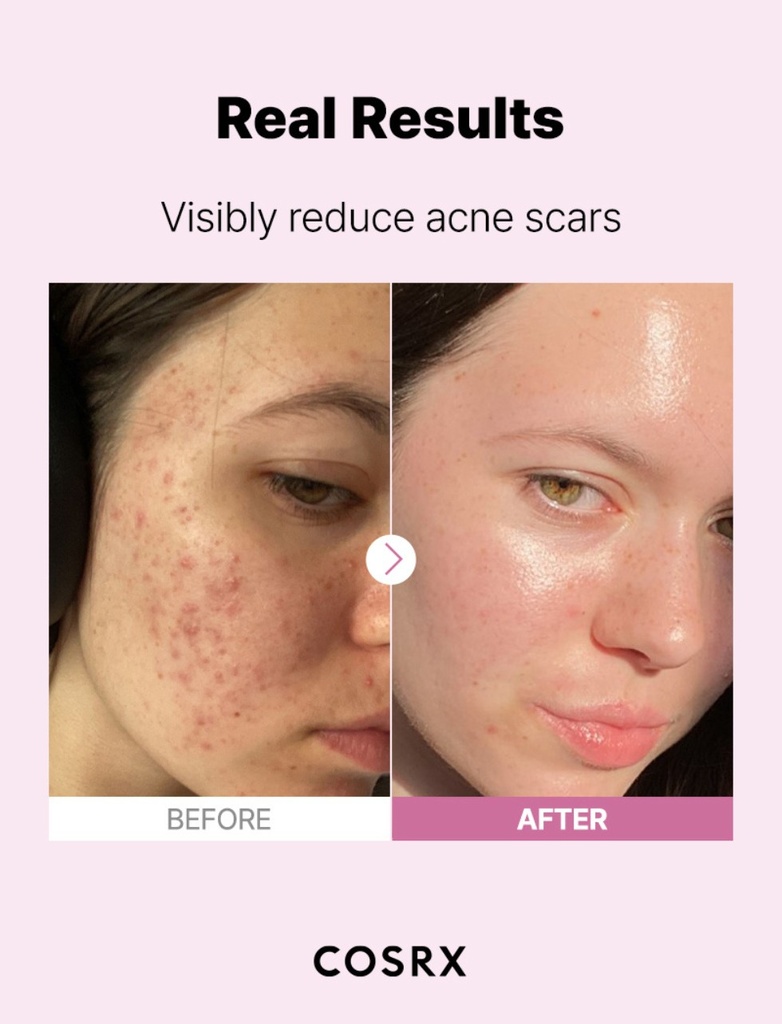 Cosrx The Niacinamide 15 serum