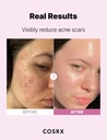Cosrx The Niacinamide 15 serum