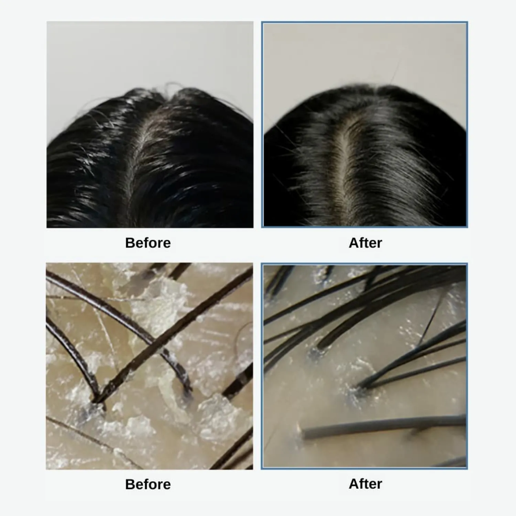 Grows Sea Salt Therapy Scalp Scaler 120g  