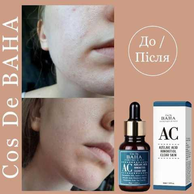 Cos De Baha Azelaic Acid Hinokitiol Clear Skin 30ml