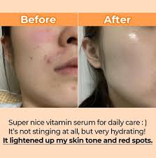 Numbuzin NO.5 VITAMIN CONCENTRATED SERUM 30ML