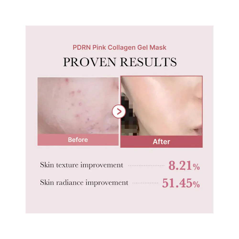 Medicube PDRN Pink Collagen Gel Mask 