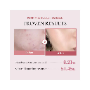 Medicube PDRN Pink Collagen Gel Mask 