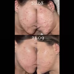 Iunik Centella Calming Ac Spot Cream 20ml