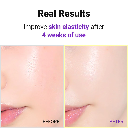  Isntree HYPER RETINOL EX 1.0 SERUM 20ML
