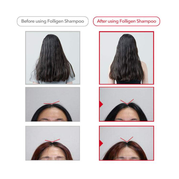 Dr.FORHAIR Folligen Original Shampoo 500ml 