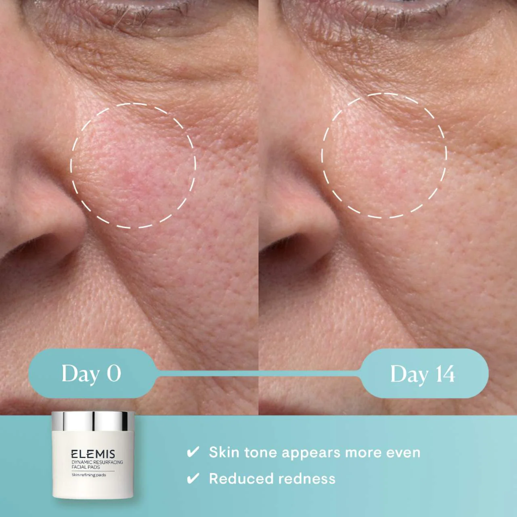 Elemis Dynamic Resurfacing Facial Pads