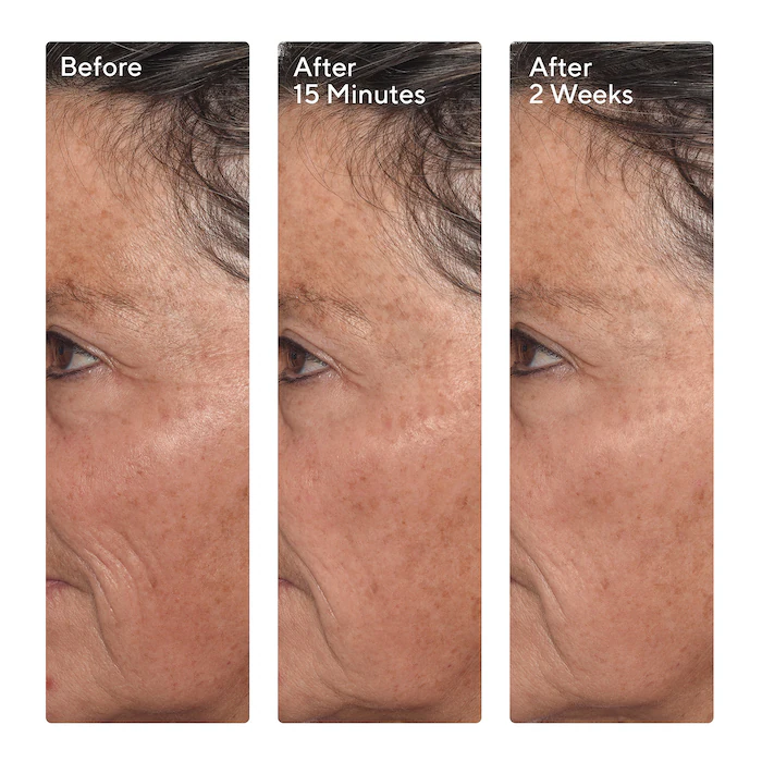 Murad Targeted Wrinkle Corrector 15 ml