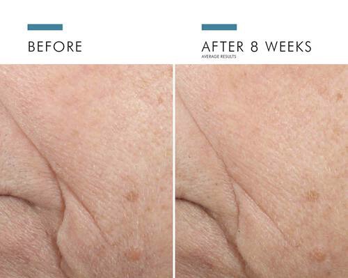 Skin Ceuticals Triple Lipid Restore 2:4:2 Correct 48ml