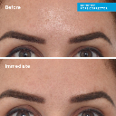 Murad Targeted Pore Corrector 15ml